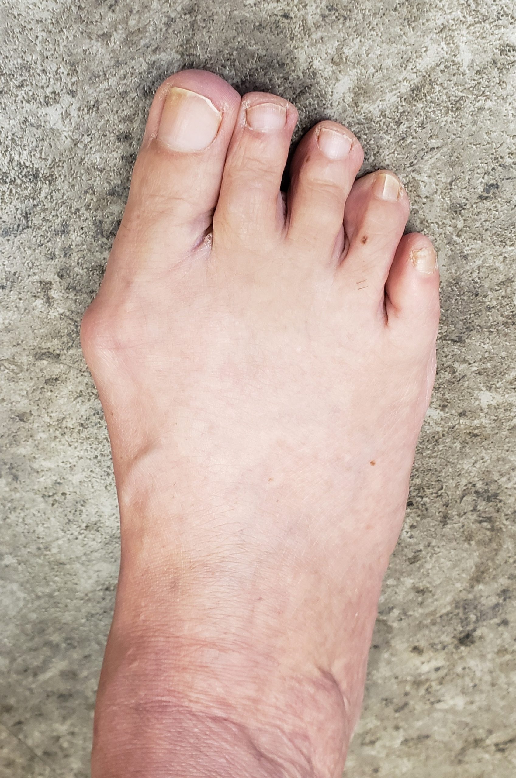 Podiatry – On the Move Podiatry